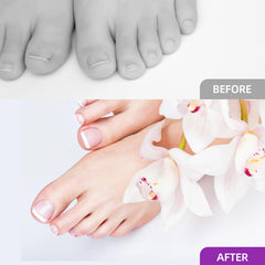 Tbestmax clips secure forms during curing for clean results.