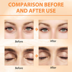 Tbexem Revive Glow eye balm jar shows rich consistency and spa-like glow.