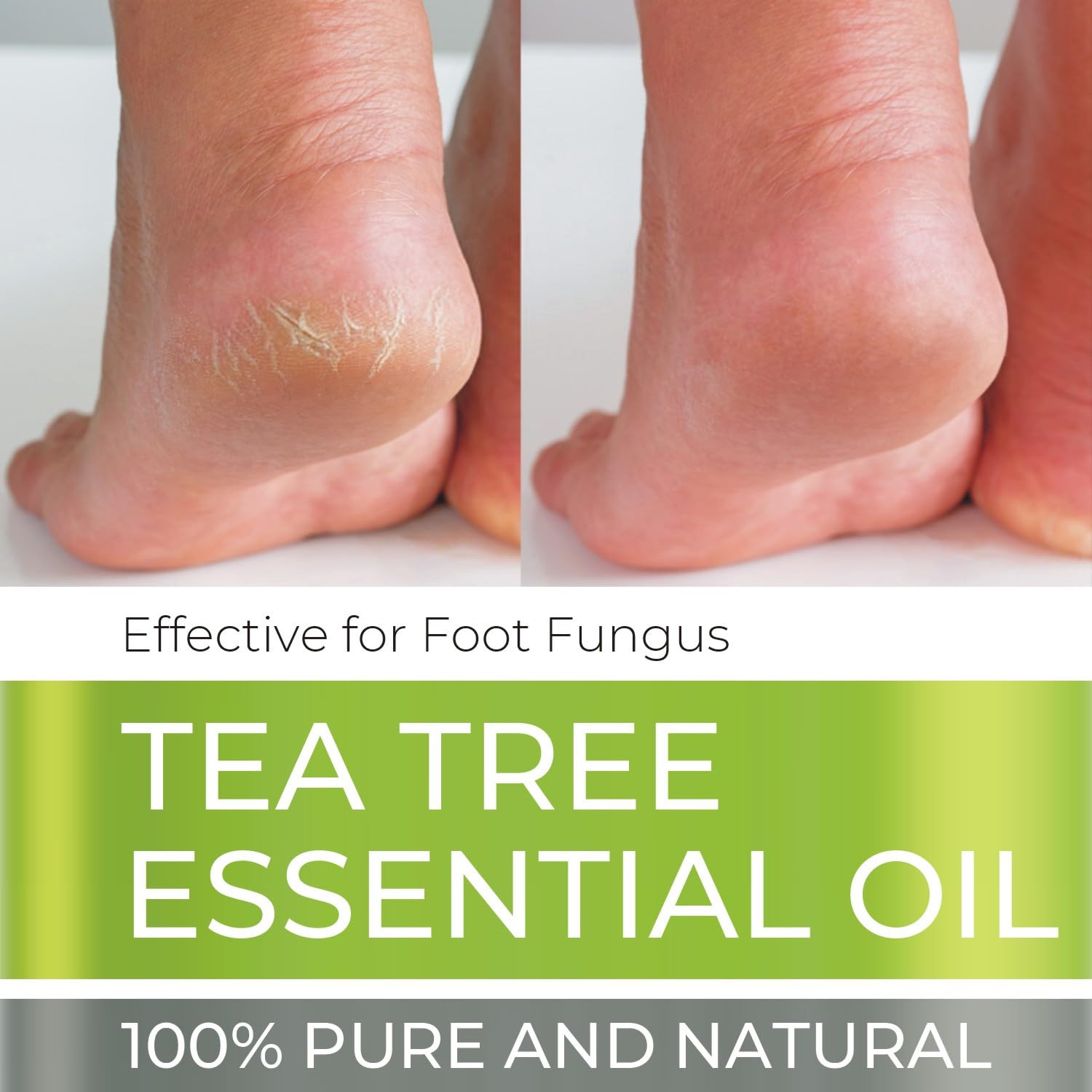 Side angle of 4 oz tea tree essential oil bottle with dropper