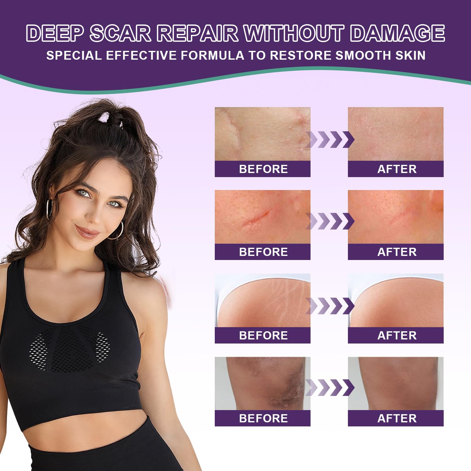 Travel-friendly Tearich silicone scar cream bottle for convenient touch-ups