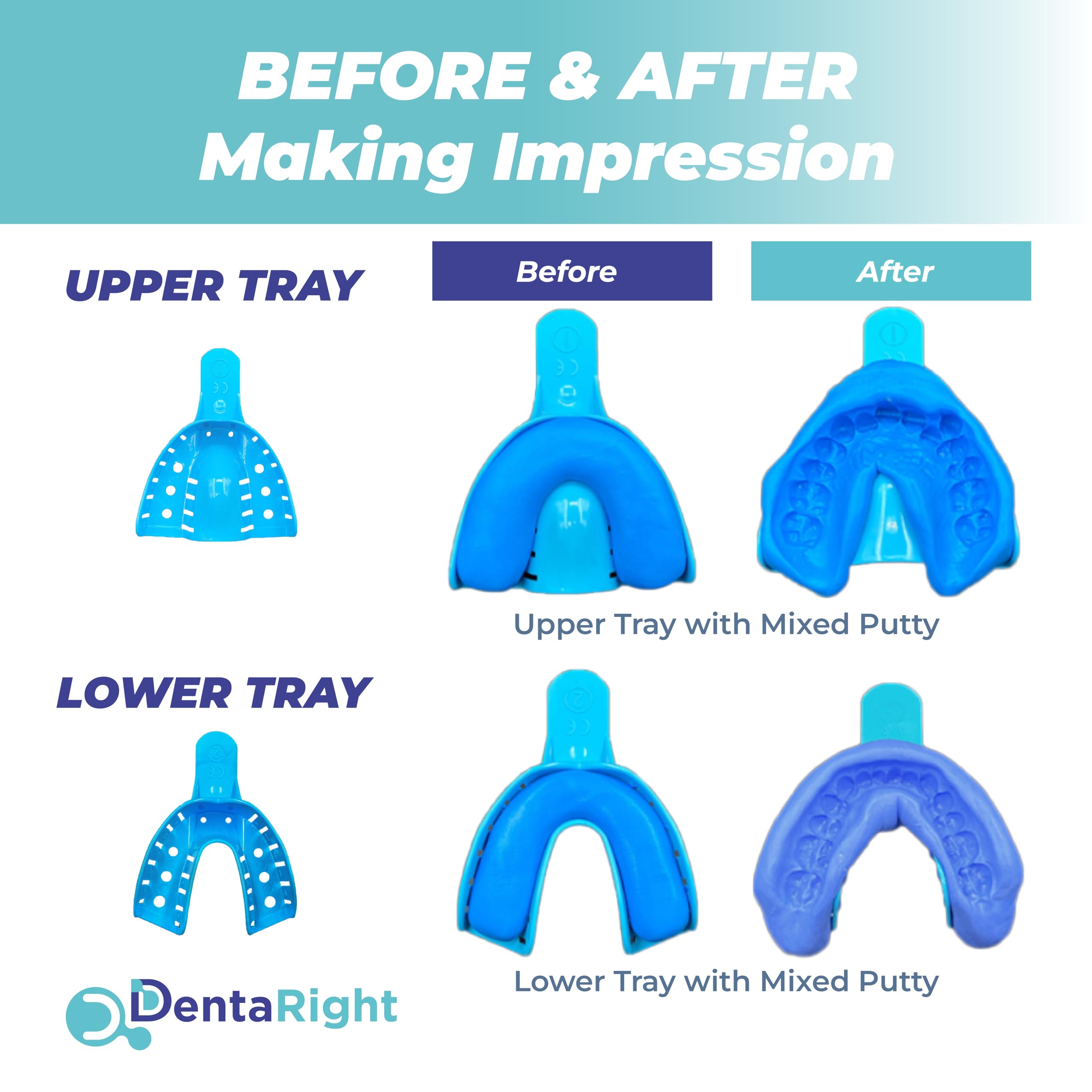 Protects teeth from daily wear