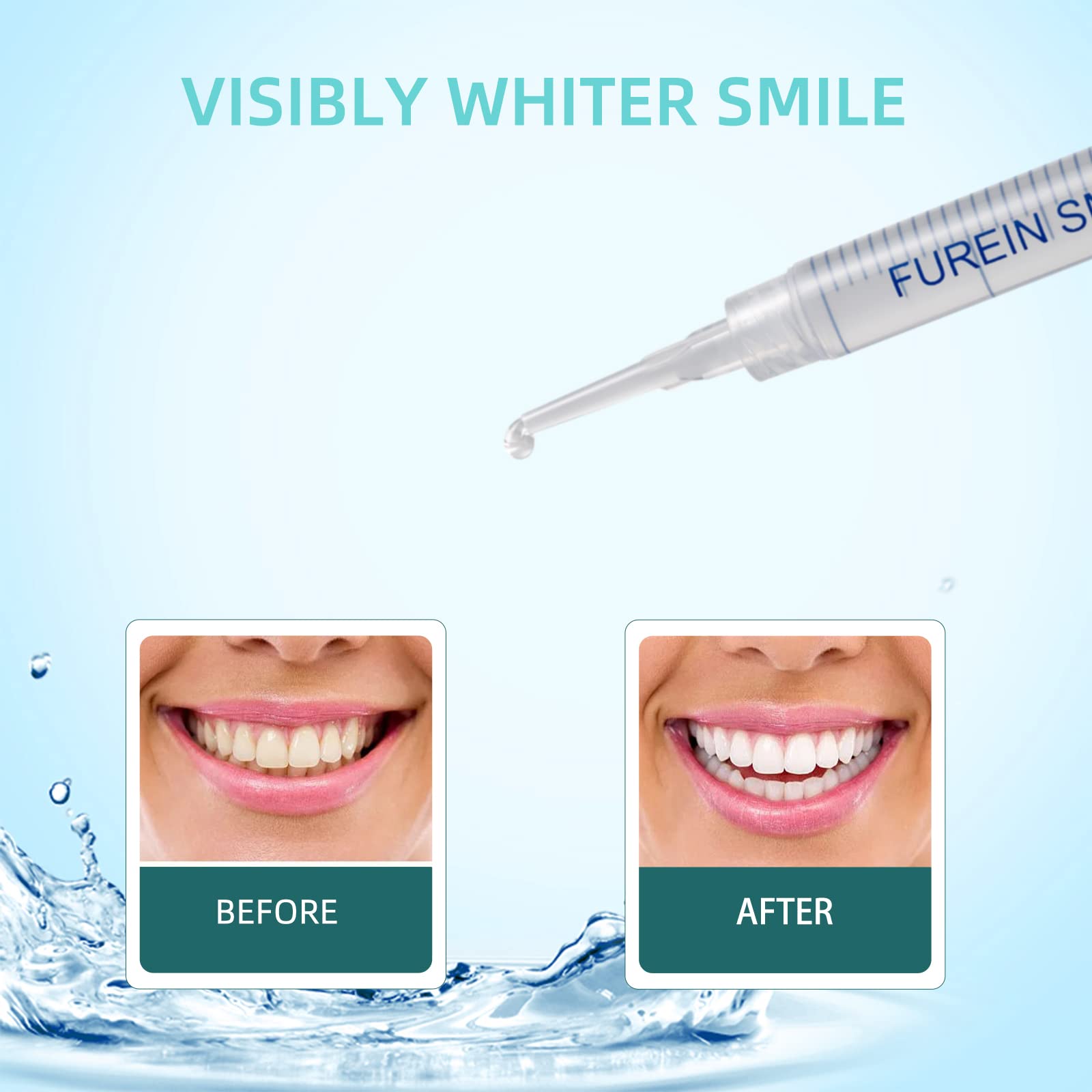 Close-up of whitening gel on a tooth surface