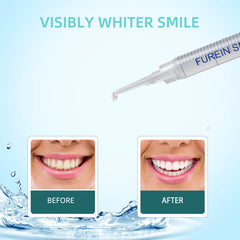 Close-up of whitening gel on a tooth surface