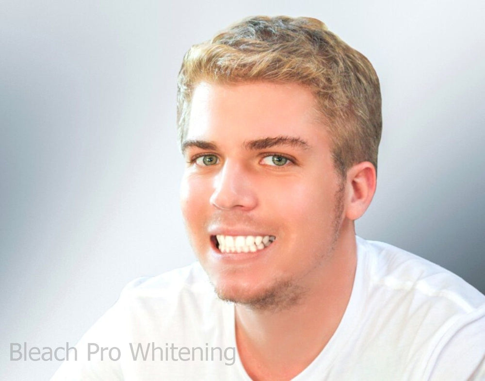 DIY teeth whitening at home setup