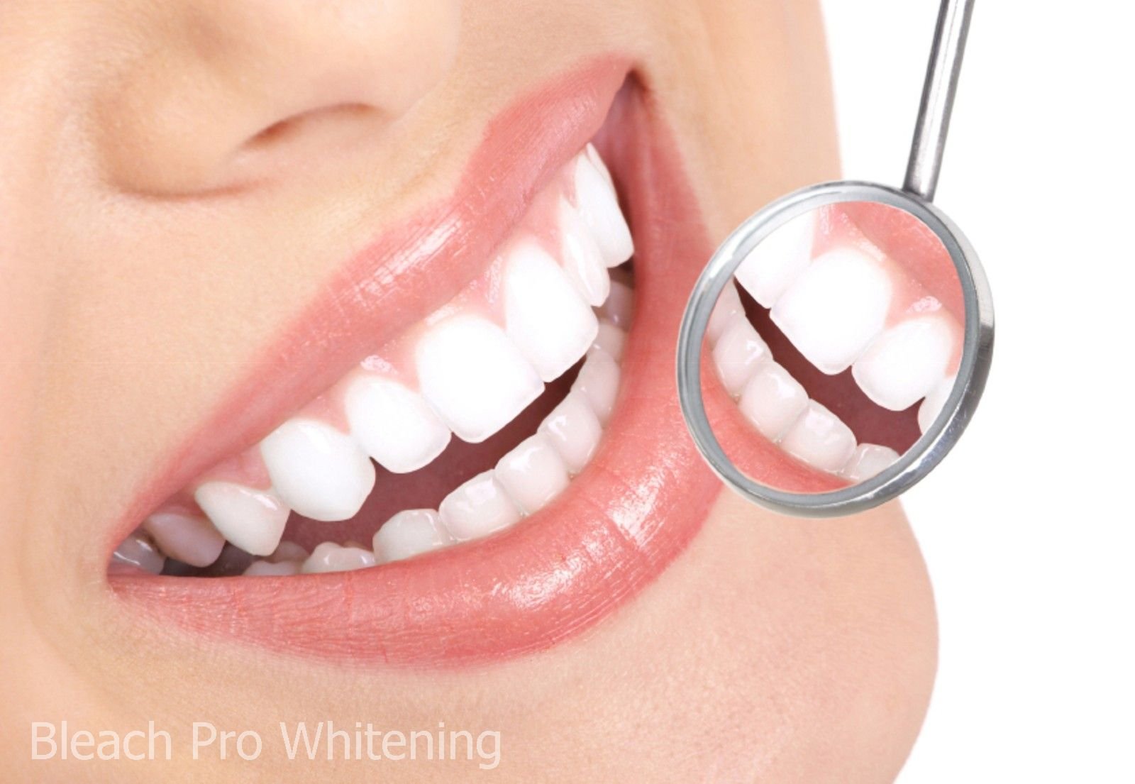 Whitening gel kit components on white background