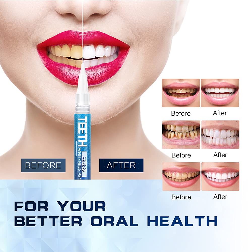 Close-up of whitening gel pen tip