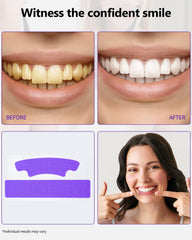Enamel-safe whitening strips designed for sensitive teeth
