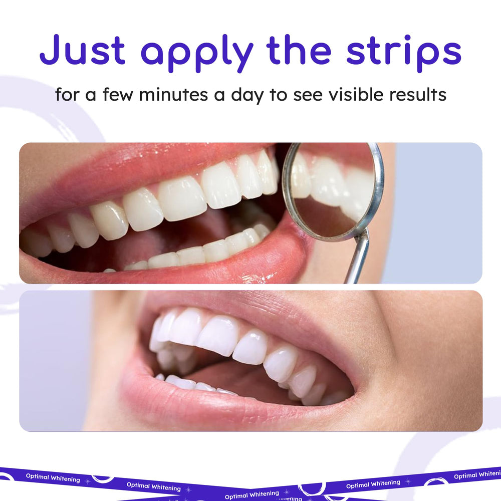 Open kit showing 14 pouches with upper and lower whitening strips