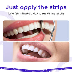 Open kit showing 14 pouches with upper and lower whitening strips
