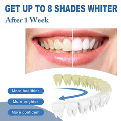 Smile showing whiter teeth after using the essence pen