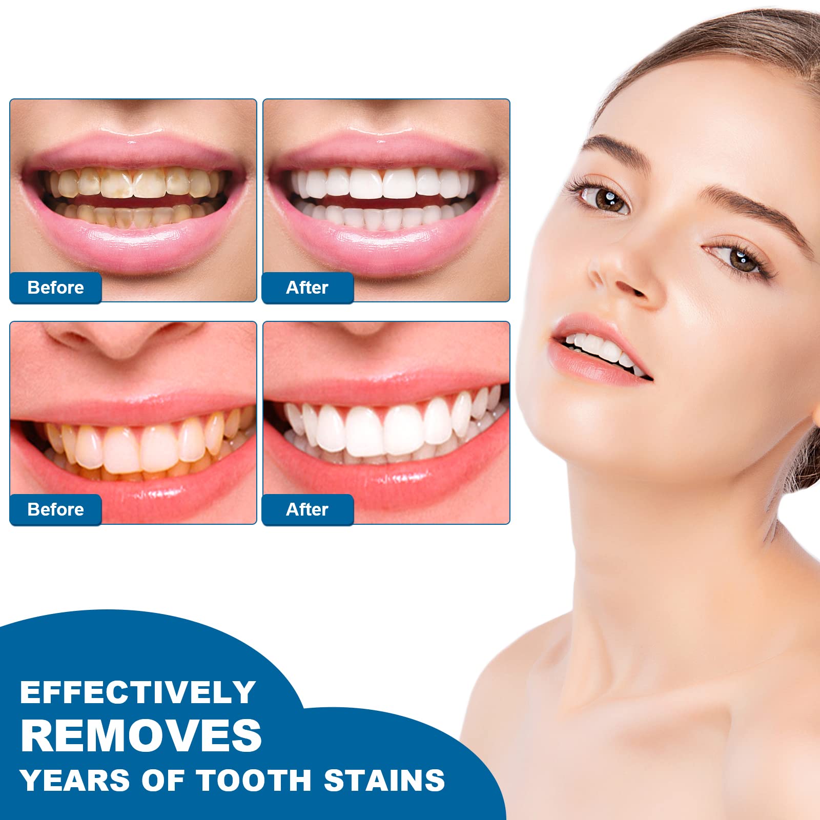 Pen removing coffee and tea stains from teeth