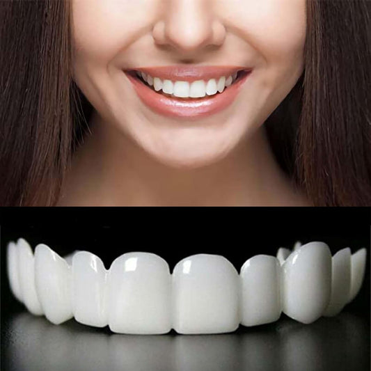 Temporary Adjustable Smile Support – top view