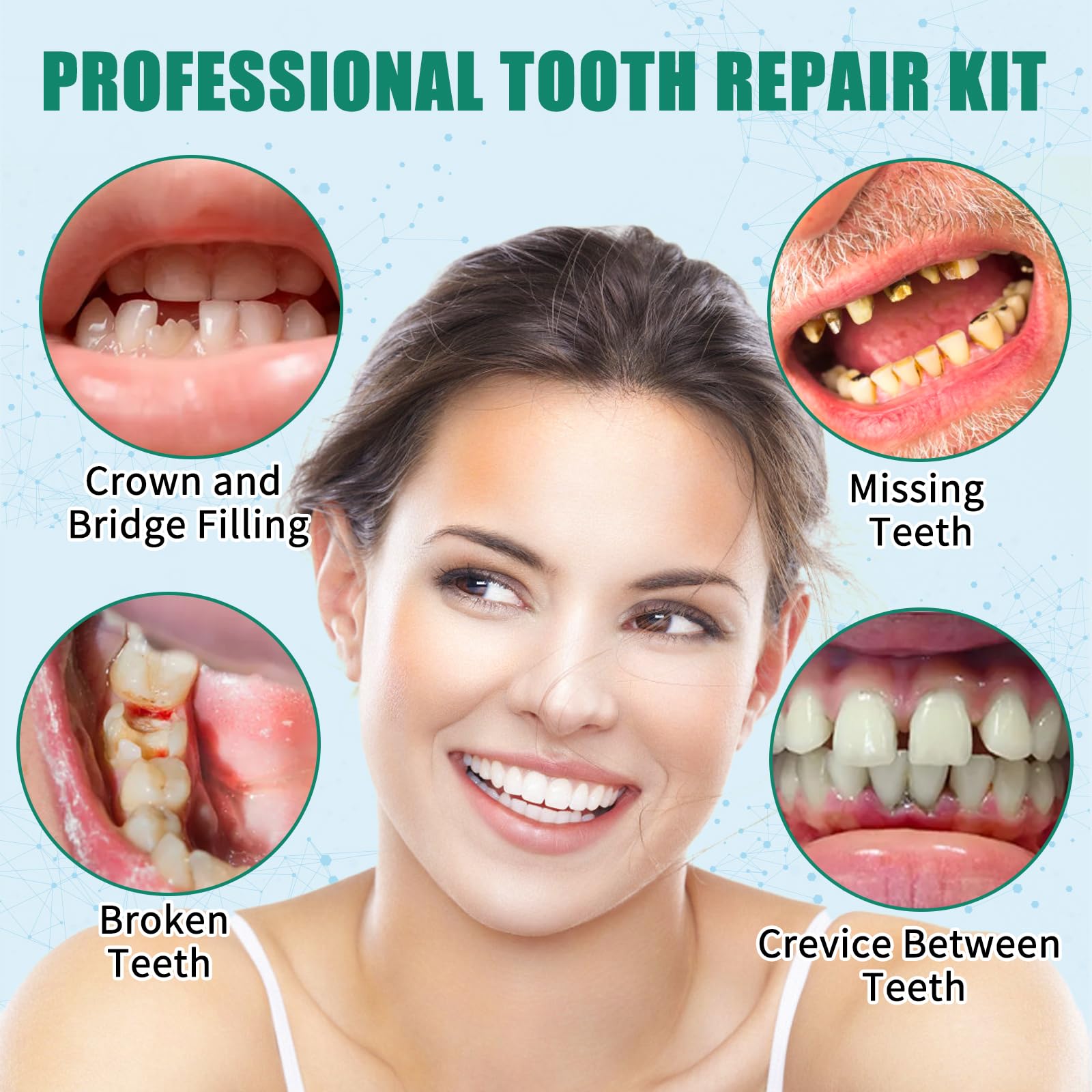 Zinc oxide eugenol cement for temporary crowns and bridges