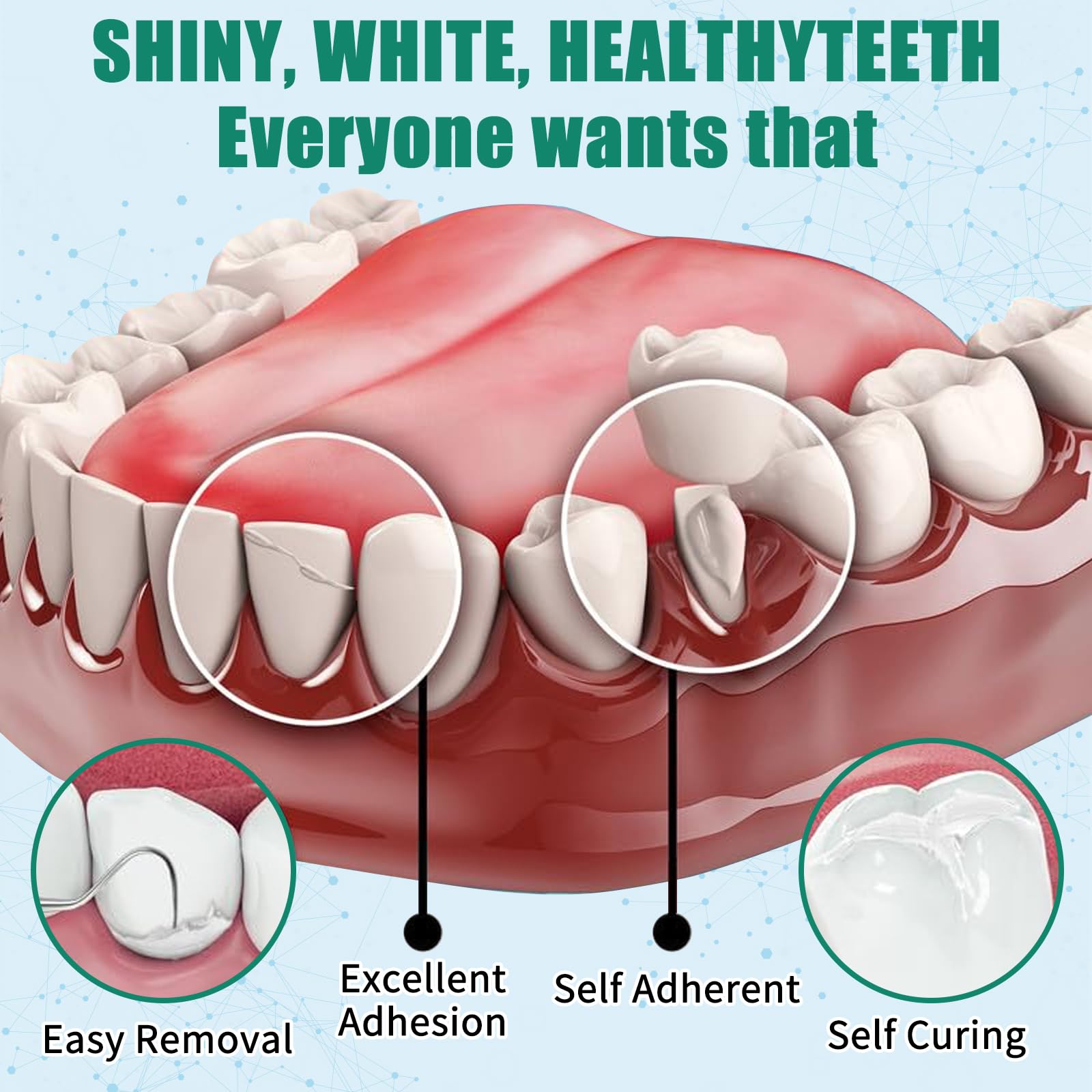 Dental care kit components for temporary fillings