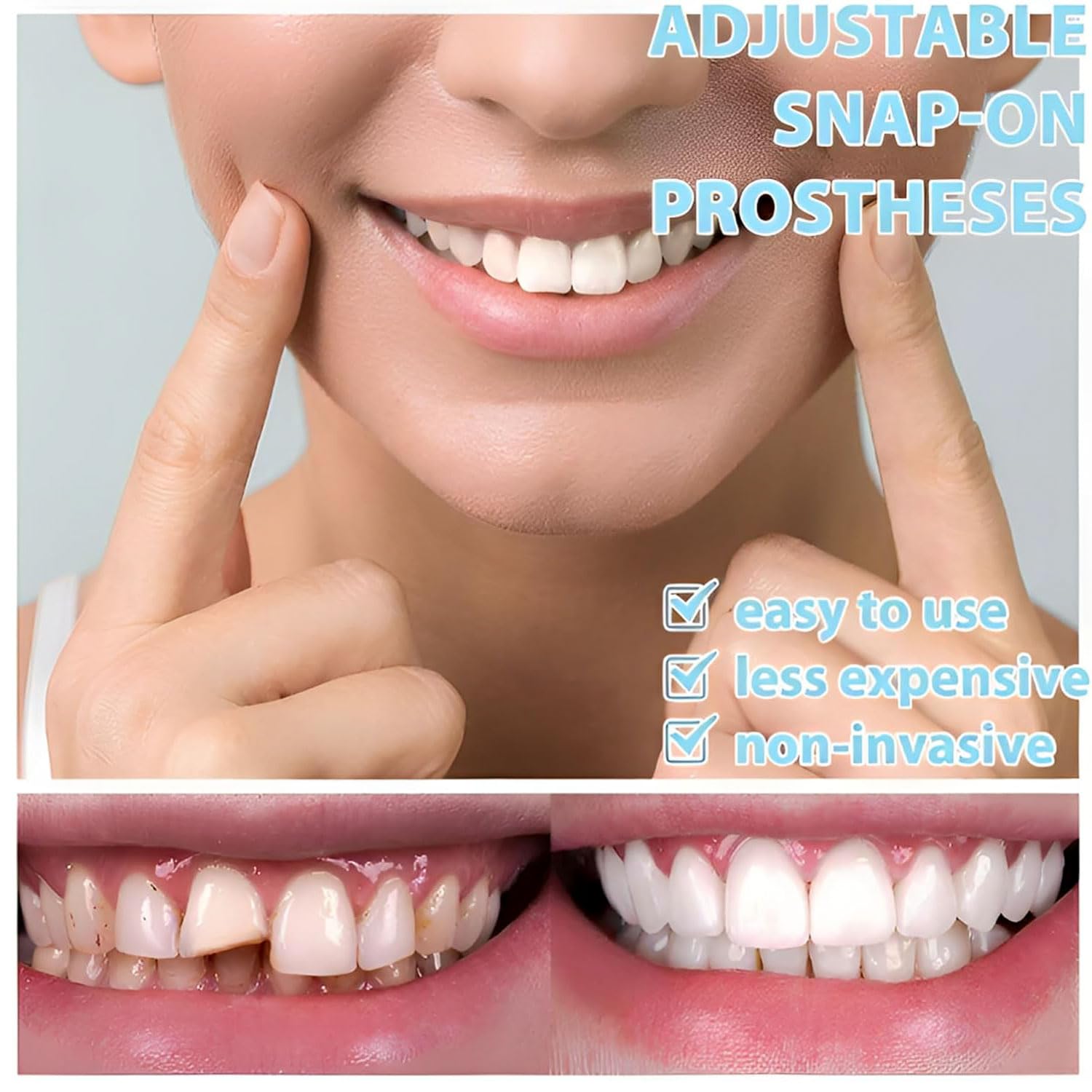 Natural and comfortable veneer for a confident smile