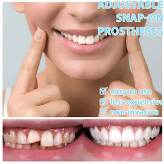 Natural and comfortable veneer for a confident smile