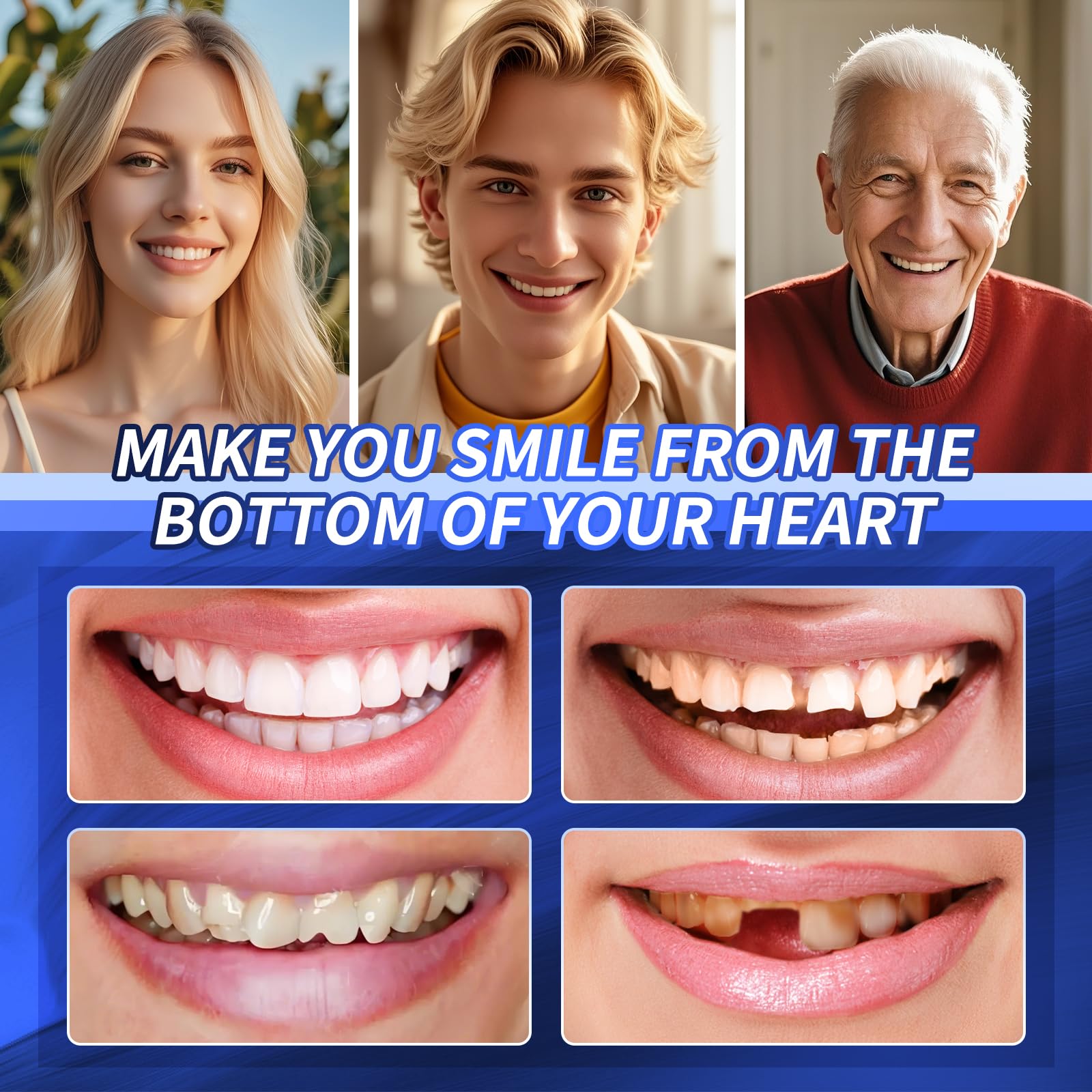 Durable and reusable veneers components