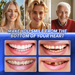 Durable and reusable veneers components