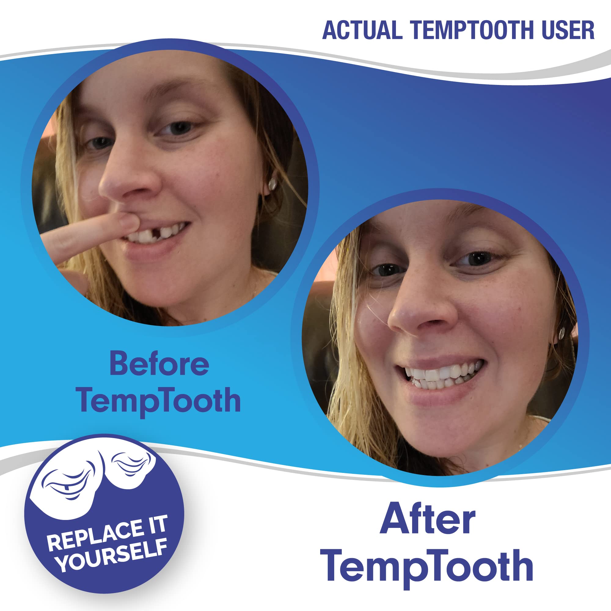 Bead molded into a natural-looking temporary tooth