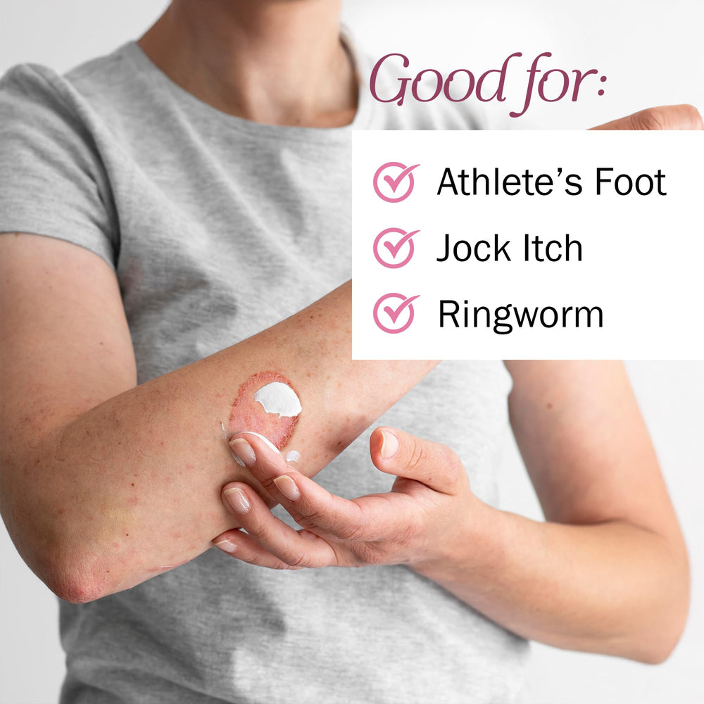 TenderGentle cream being spread on skin to address itching and discomfort.