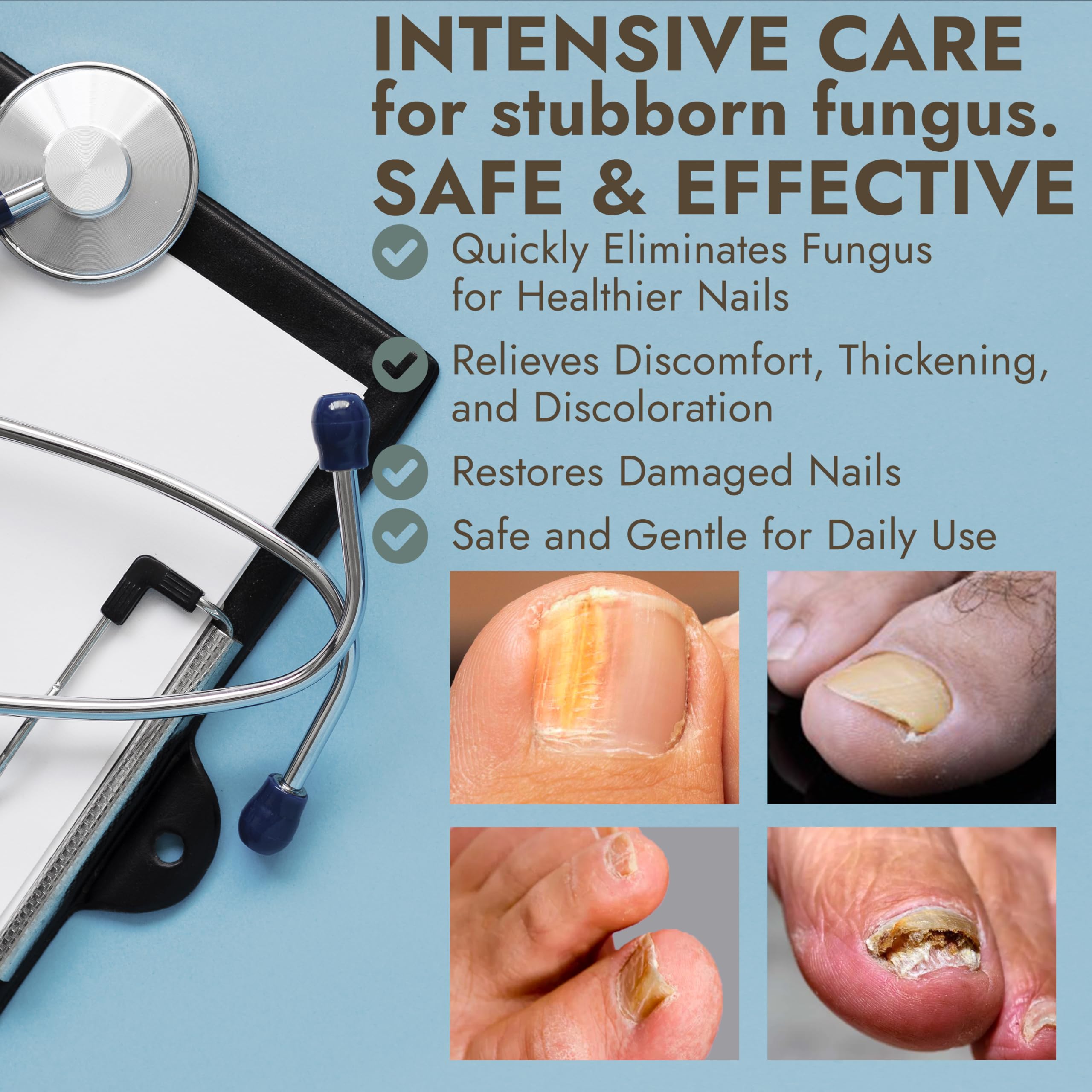 Terramed Discoloration reduction close-up showing improved nail appearance.