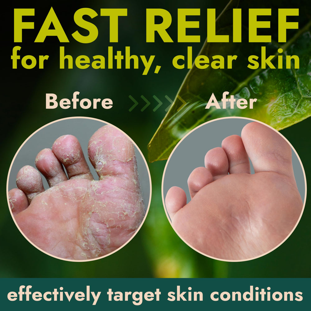 Terramed foot cream targets toes soles and nails for smoother skin