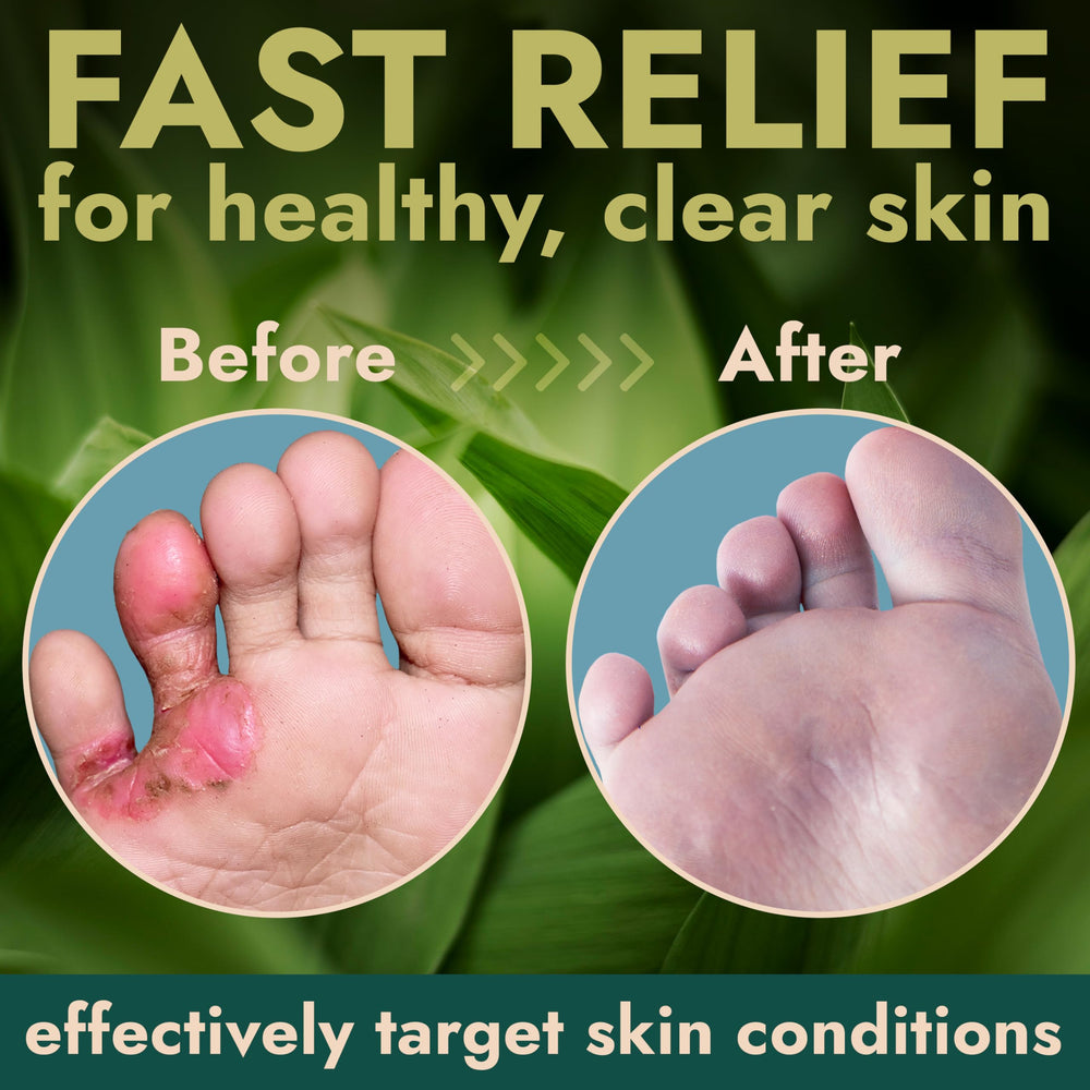 Terramed Just Think Comfort dry cracked feet with gel hydration close-up