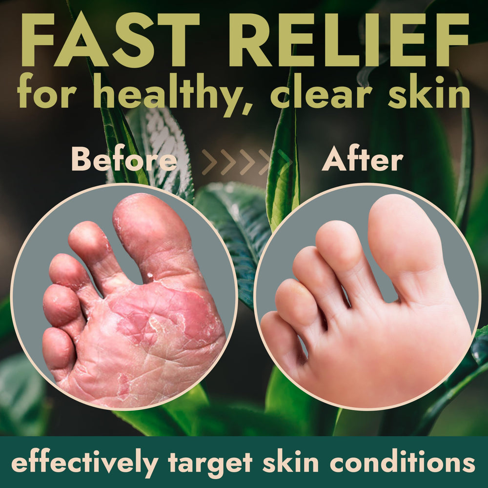 Terramed Just Think Comfort protective foot care barrier helps prevent reinfection.