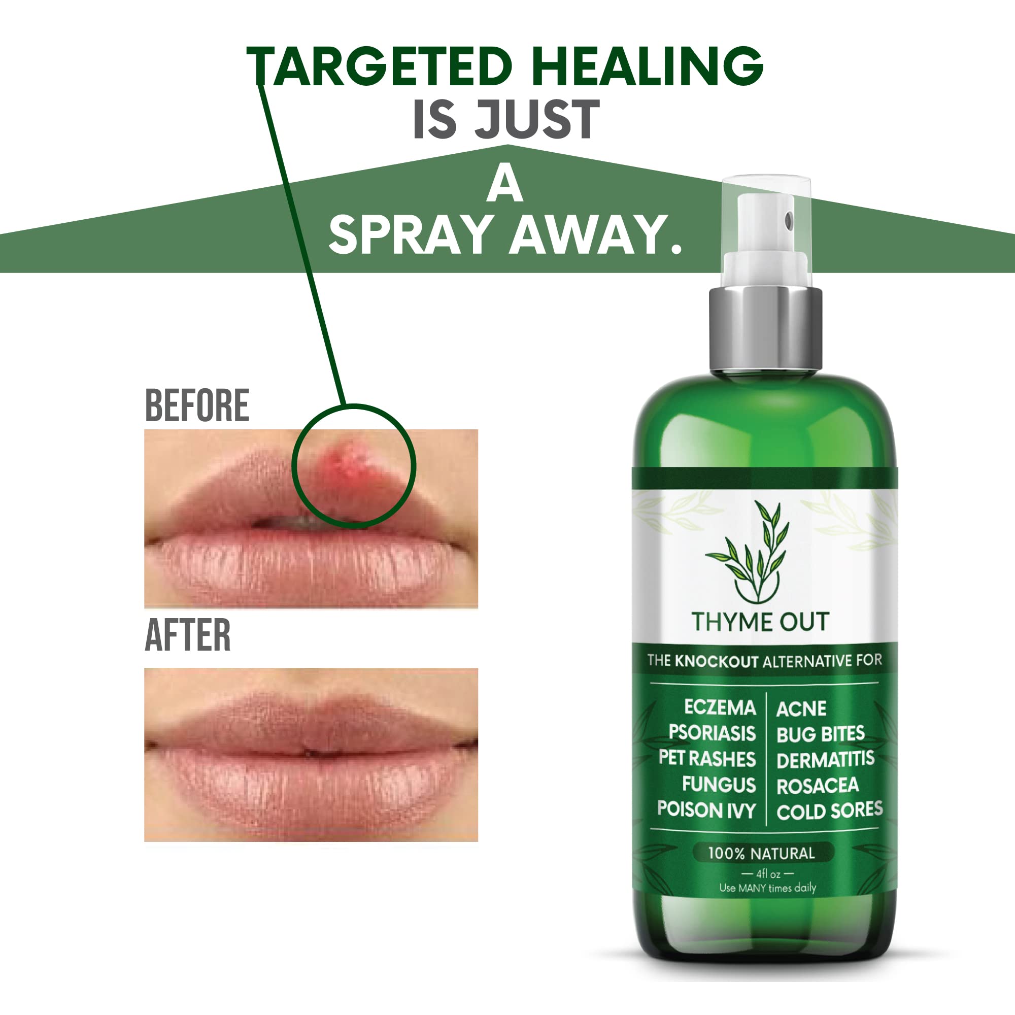 Thyme Out packaging and 4oz bottle emphasize a compact, travel-friendly size.