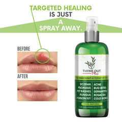 Thyme Out Plus bug-bite-relief spray soothes itching outdoors and reduces redness