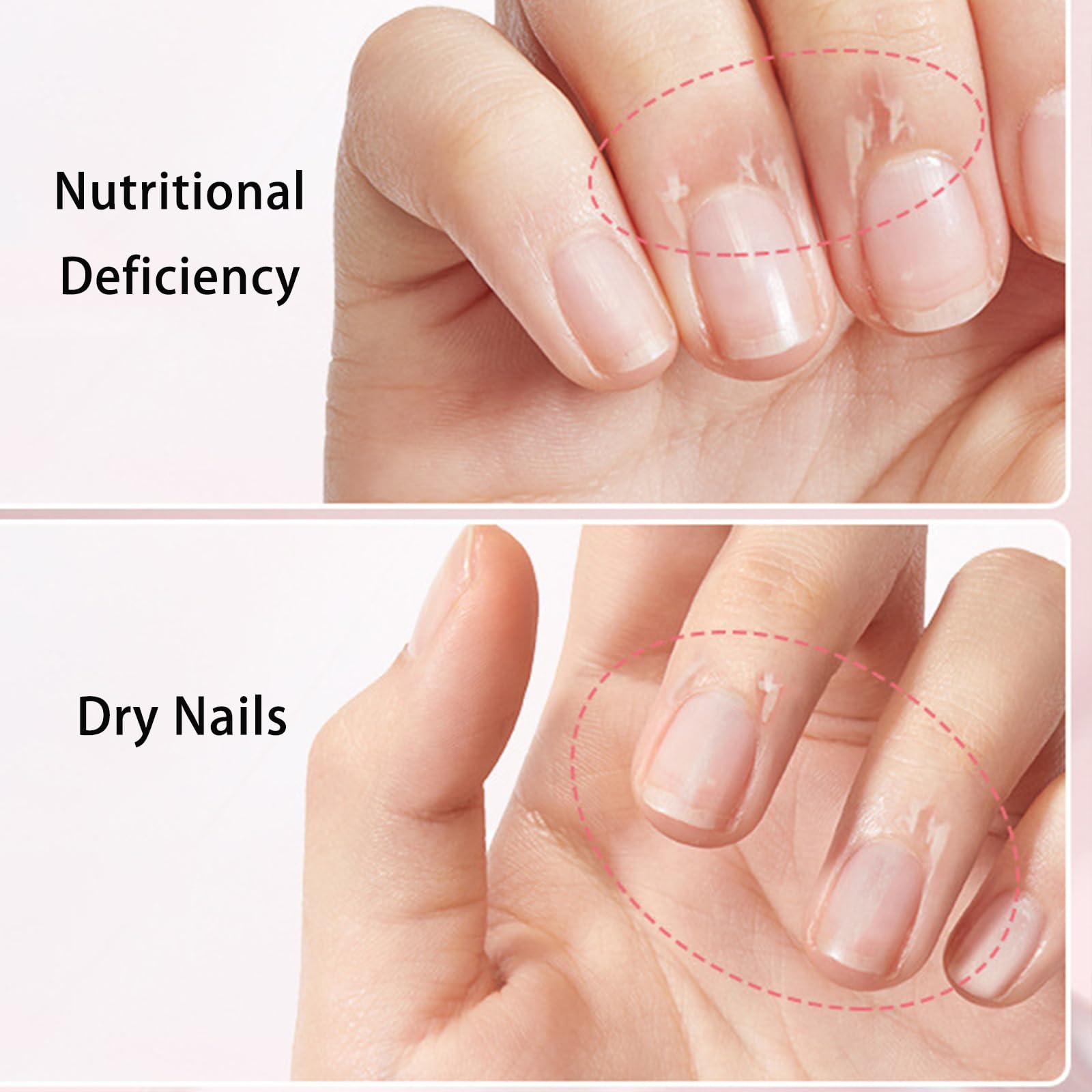 Close-up of Tiliraiy Nail Growth Pen applying product precisely.