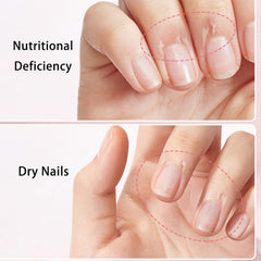 Close-up of Tiliraiy Nail Growth Pen applying product precisely.
