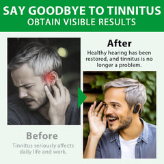 Capsules in a clear dish showing tinnitus relief capsules