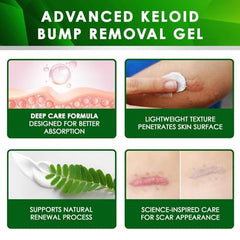 Tobcharm face scar removal gel suitable for sensitive facial skin and post-piercing care.
