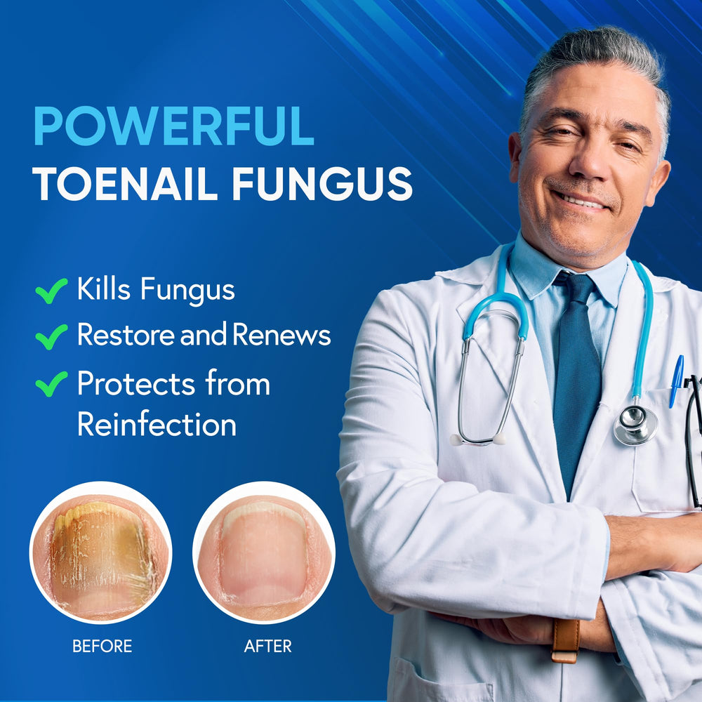 Tobcharm Toenail Fungus Treatment bottle-right focus highlights dual-bottle setup for extra strength.
