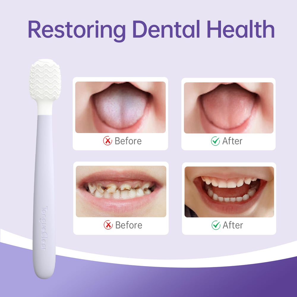 Ultra-soft 360° brush head cleaning all areas of baby's mouth