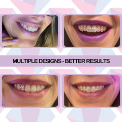 UV light for curing tooth gems