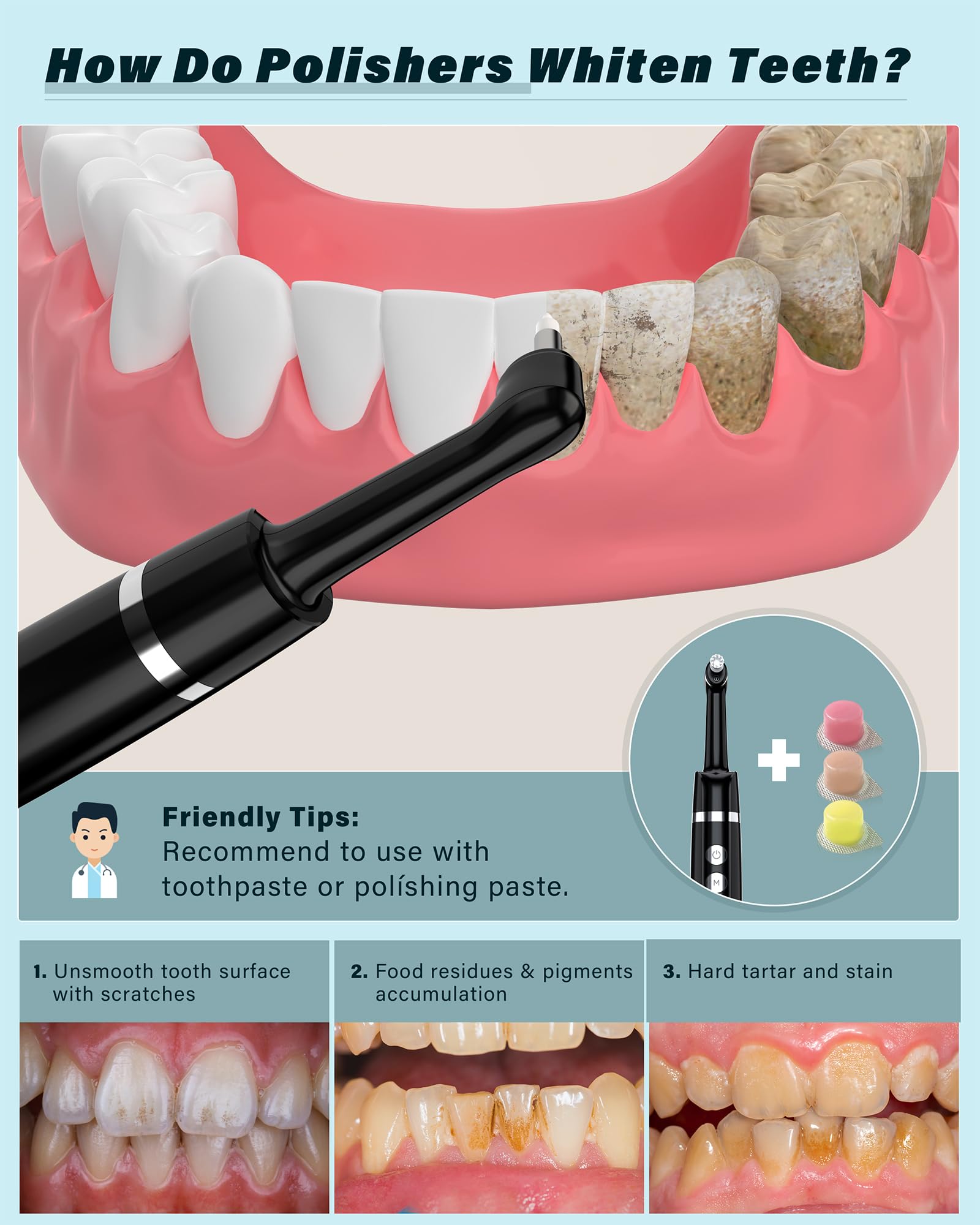 Tooth polisher black side profile
