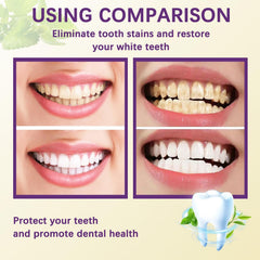 Whitening action showing removal of coffee stain on a tooth