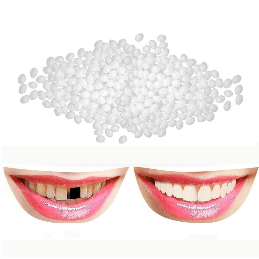 Tooth Repair Kit beads and tools laid out on a white surface