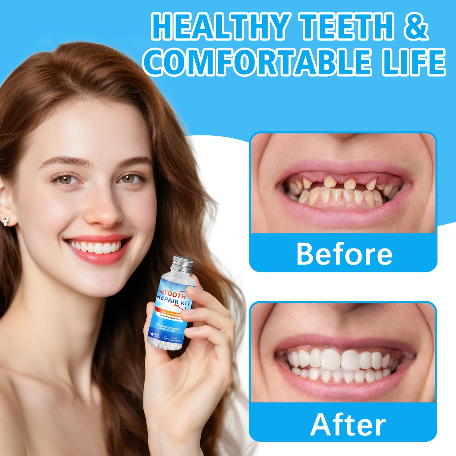Thermoplastic beads for temporary dental repair