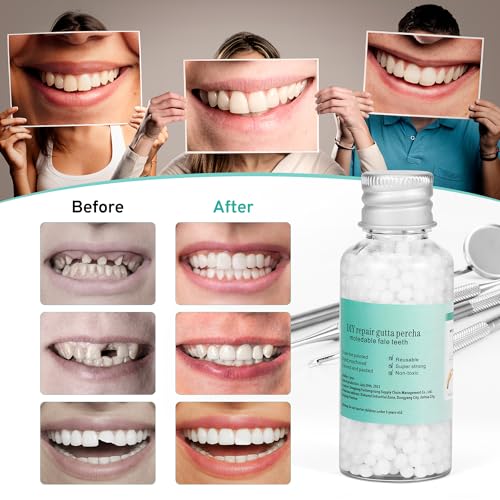 Hands shaping moldable beads to fit a tooth