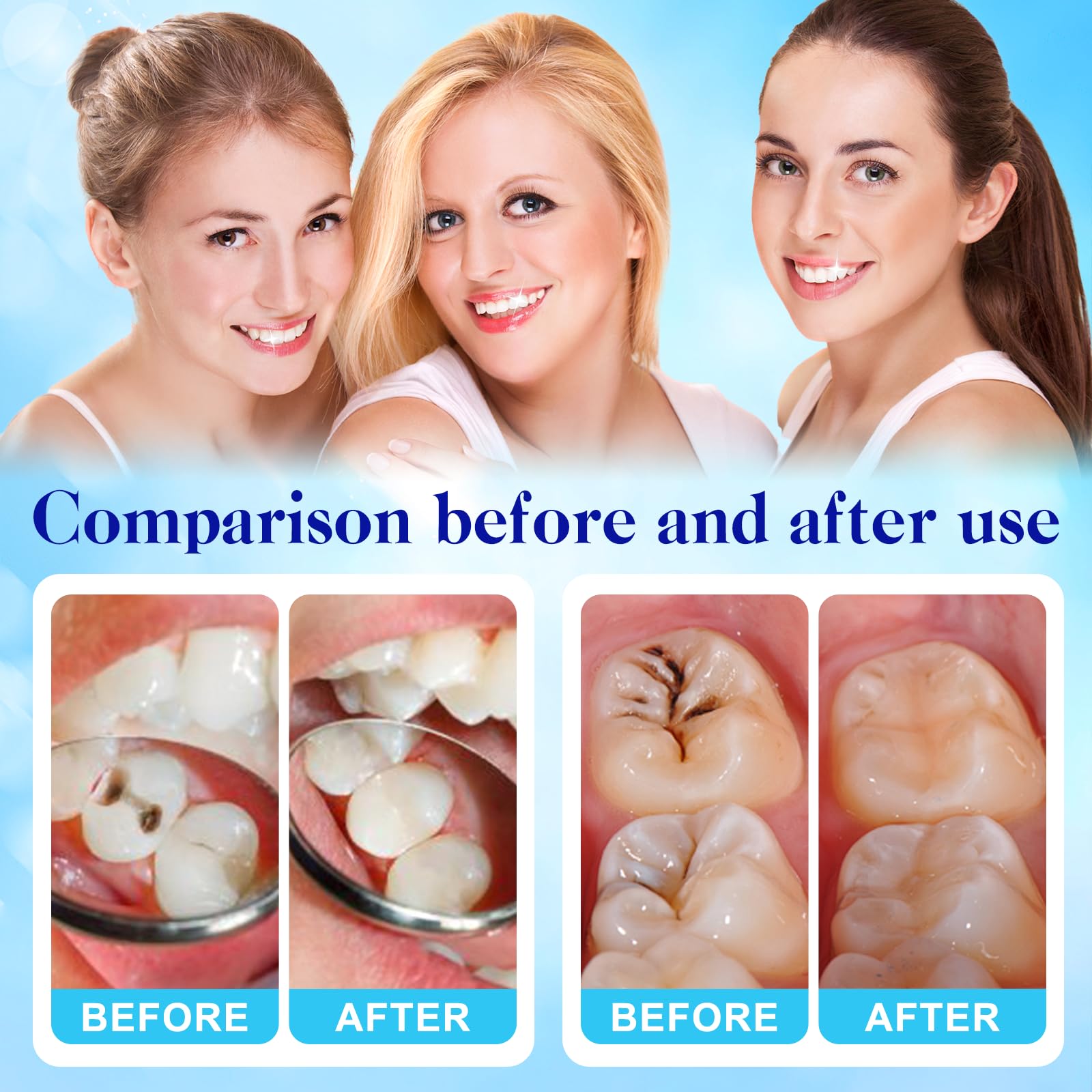 Liquid component (16ml) of the Tooth Repair Kit