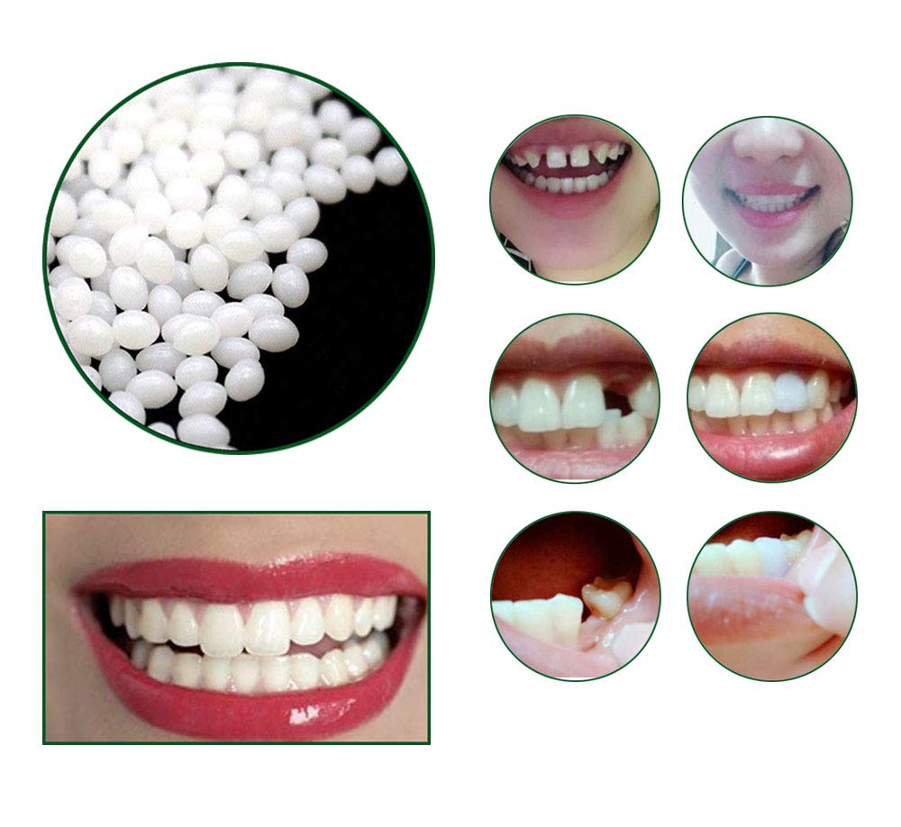 Person smiling with a temporary tooth restoration