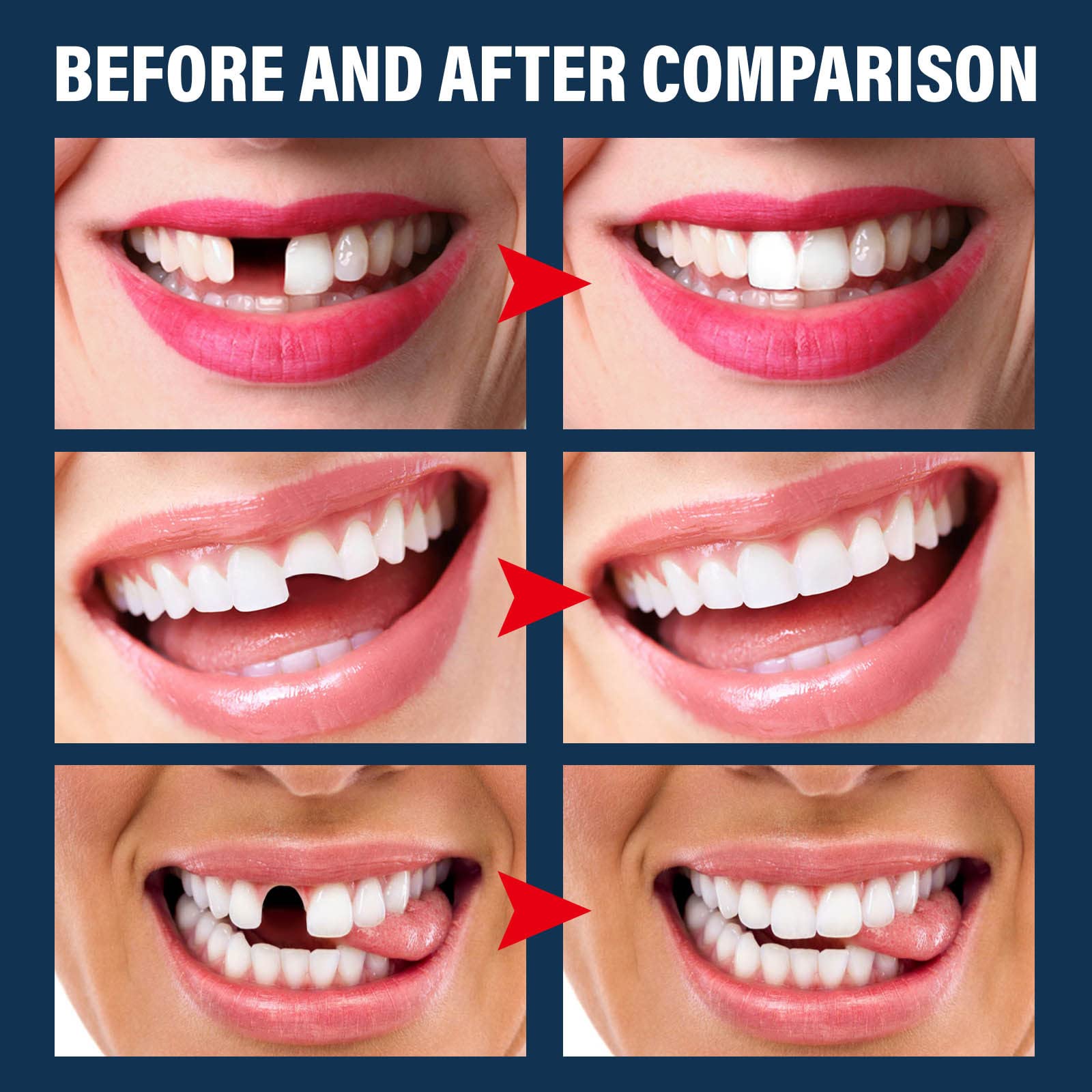 30ml moldable thermal fitting bead for tooth repair