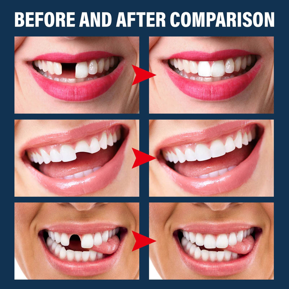 30ml moldable thermal fitting bead for tooth repair