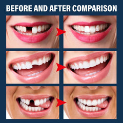 30ml moldable thermal fitting bead for tooth repair