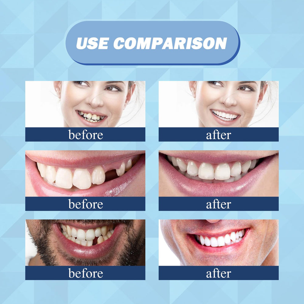 Temporary tooth repair in place and worn