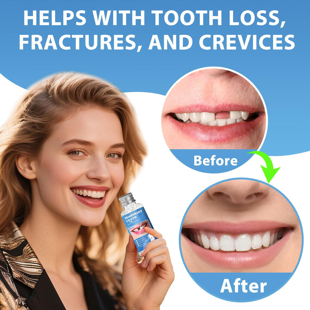 Soft, comfortable beads for temporary tooth restoration