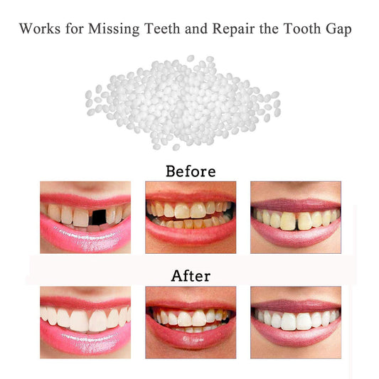 Tooth Repair Kit with beads and instruction manual